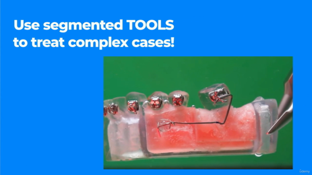 Foundations of Orthodontic Biomechanics – Screenshot 3