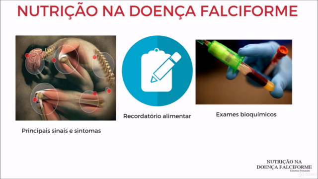 Nutrição na Doença Falciforme – Screenshot 2