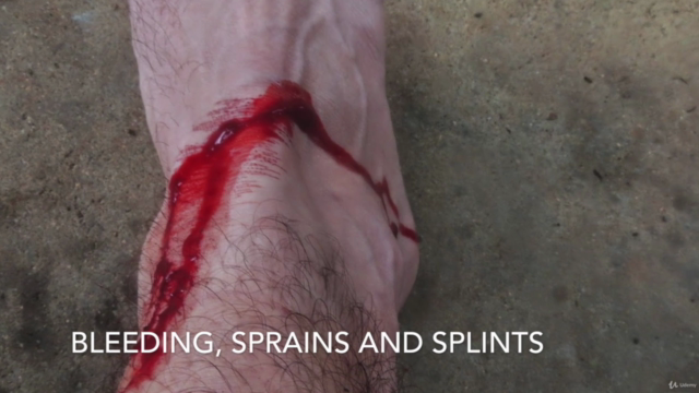 Wilderness (Outdoor) First Aid – Screenshot 3