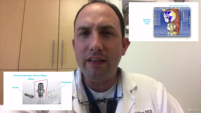 Restoring Dental Implants with CEREC and TiBase – Screenshot 2