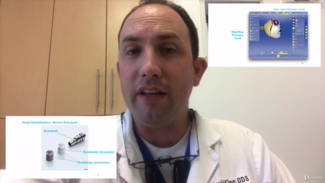 Restoring Dental Implants with CEREC and TiBase – Screenshot 3