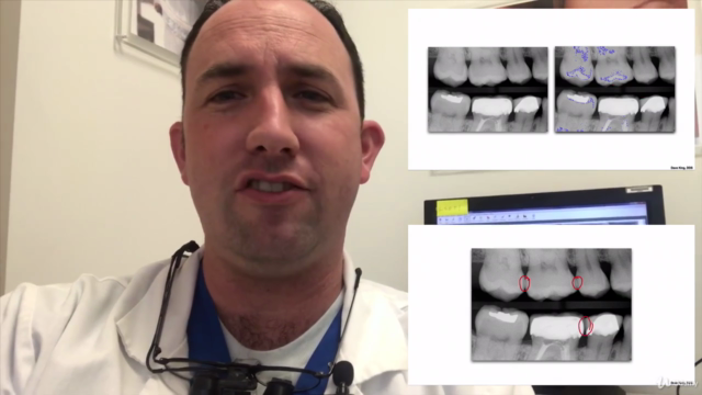 Dental X-rays for Dum Dums – Screenshot 3