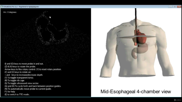 Basic Echocardiography for Beginners – Screenshot 3