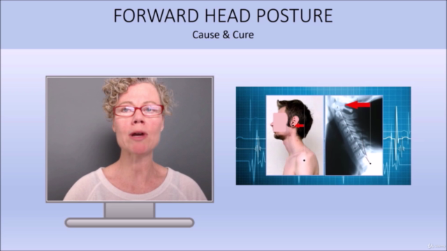 Correcting Forward Head Posture: Relieve Pain and Headaches – Screenshot 1