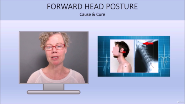 Correcting Forward Head Posture: Relieve Pain and Headaches – Screenshot 4