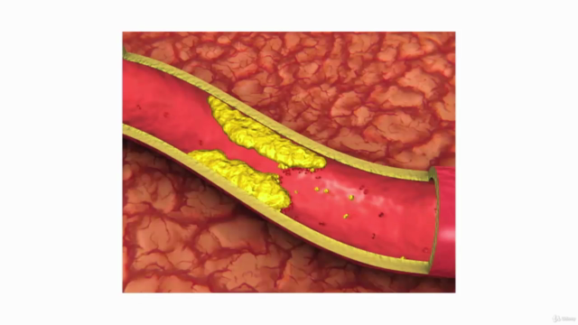 Self-Massage to Improve Blood Circulation – Screenshot 1