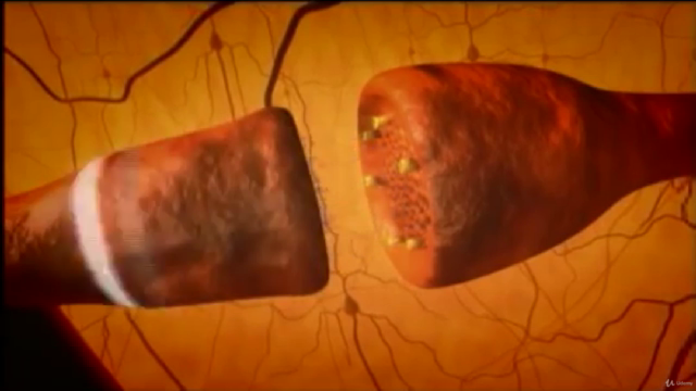 Terapia Neuro Serotonina - Aumente a Química da Felicidade – Screenshot 1