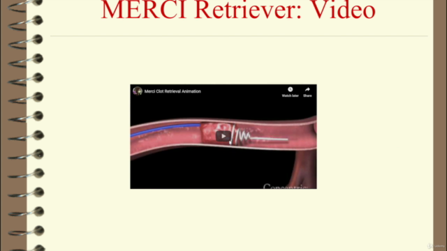 Why Stroke Matters: Neurology for Non-Neurologists – Screenshot 3