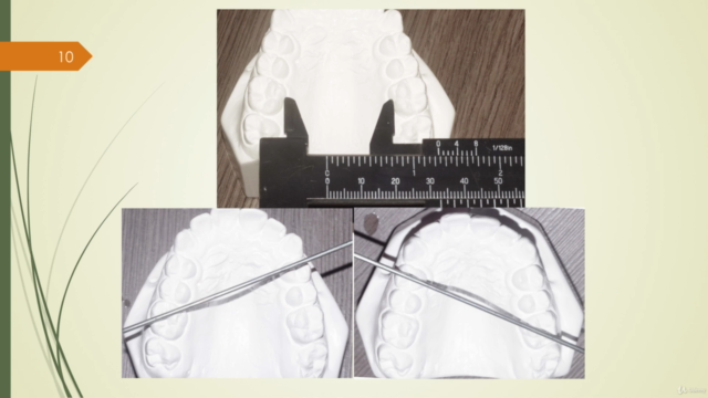 Diagnóstico Ortodôntico – Screenshot 3