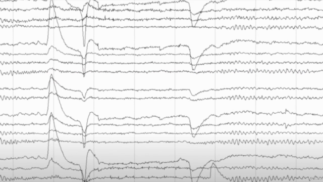 Neuroscience and Psychology: Electroencephalography (EEG) – Screenshot 3