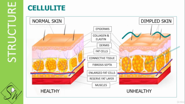 ALL ABOUT: CELLULITE & 'TOXINS' – Screenshot 2