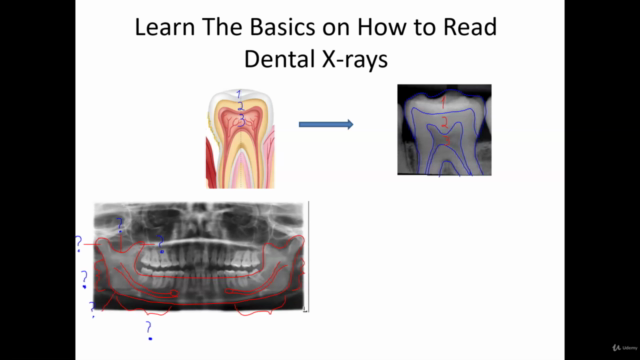 Dental X-Ray's Radiology Course – Screenshot 1