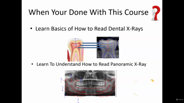 Dental X-Ray's Radiology Course – Screenshot 4