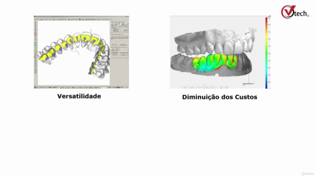 Inspeções na Odontologia com ZEISS Inspect – Screenshot 2