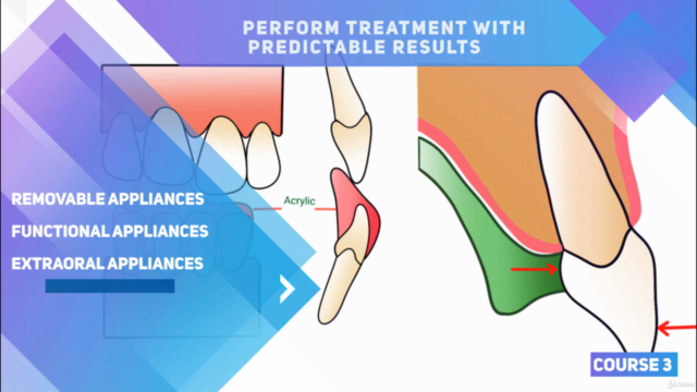 Orthodontic Removable Appliances for Dental Professionals – Screenshot 2
