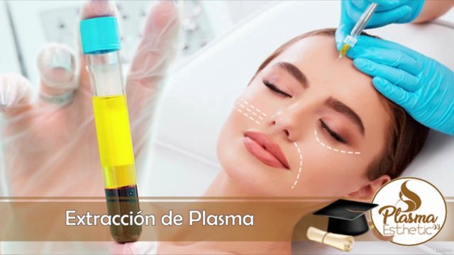 Bioestimulación con Plasma Rico en Plaquetas (P.R.P.) – Screenshot 3