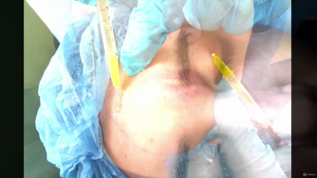 Bioestimulación con Plasma Rico en Plaquetas (P.R.P.) – Screenshot 4