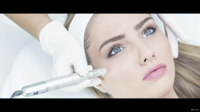 Microneedling treatment – Screenshot 1