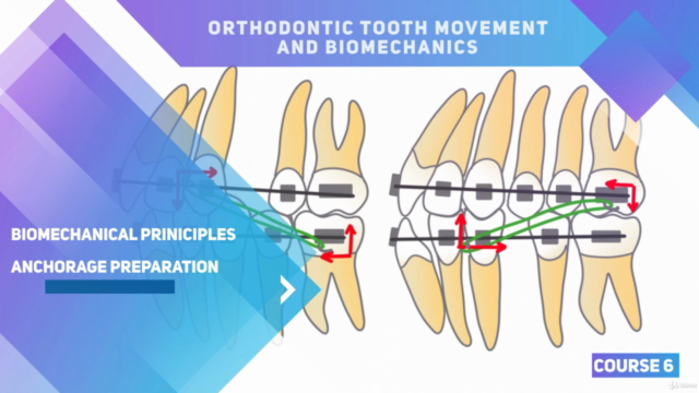 Orthodontic biomechanics and anchorage – Screenshot 2