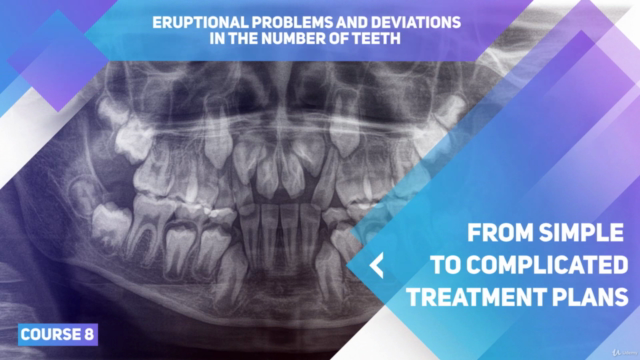 Orthodontic treatment of hypodontia and eruption problems – Screenshot 3