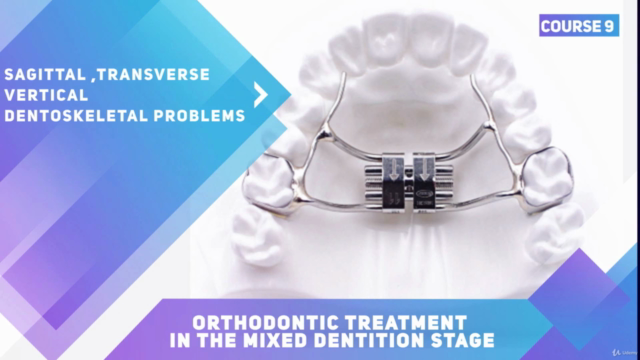 Early orthodontic treatment of dentoskeletal problems – Screenshot 2