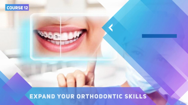 Adult Orthodontic Treatment. Minor tooth movement. – Screenshot 1