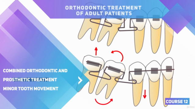 Adult Orthodontic Treatment. Minor tooth movement. – Screenshot 2