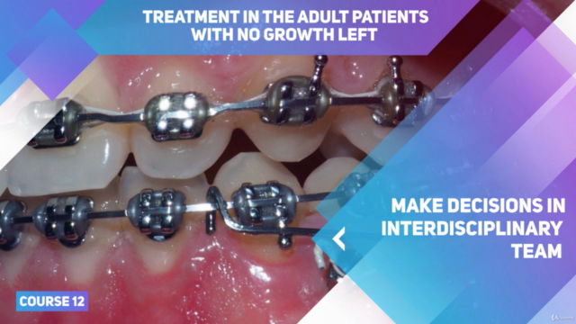 Adult Orthodontic Treatment. Minor tooth movement. – Screenshot 3