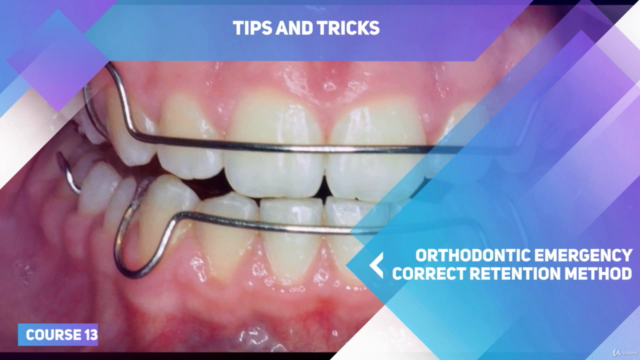 Finishing the orthodontic case and retention – Screenshot 3