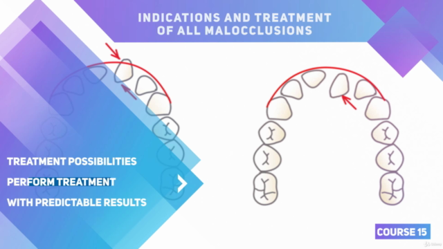 Orthodontic treatment planning for different malocclusions – Screenshot 2
