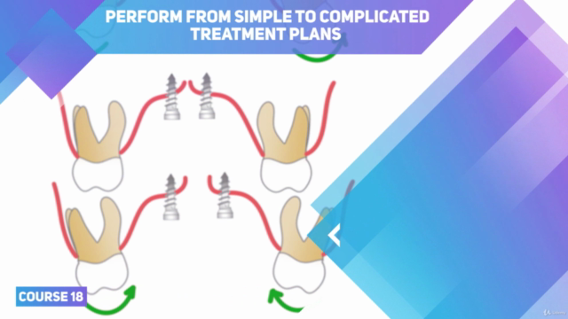 Mini Implants in Orthodontics – Screenshot 3