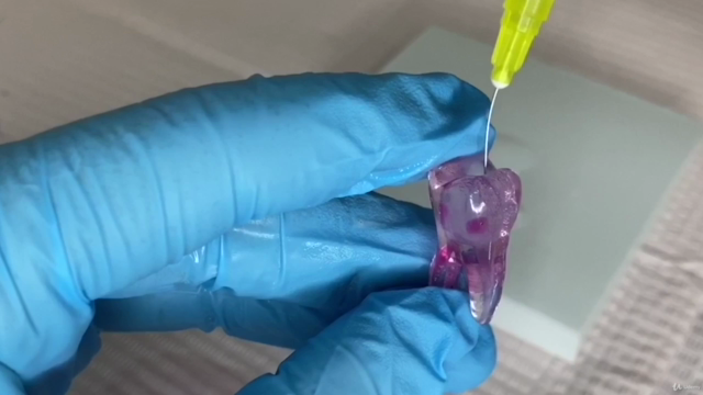 Basics of Root Canal Treatment (Endodontic Course) – Screenshot 3