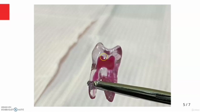 Basics of Root Canal Treatment (Endodontic Course) – Screenshot 4