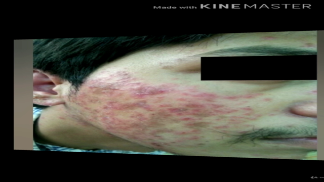 Atlas of Skin Diseases - Screenshot_04