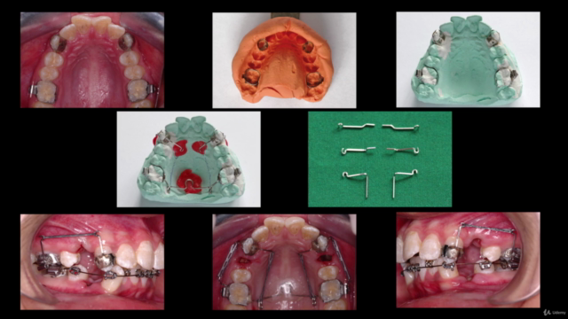Learn Clinical Photography in Dentistry – Screenshot 4