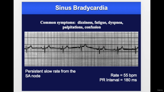 Cardiac Pacemakers- Part 1 – Screenshot 2