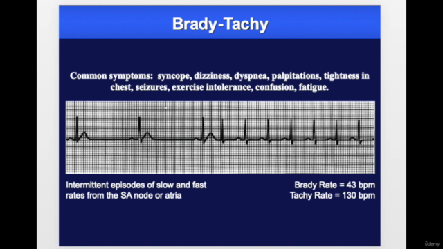 Cardiac Pacemakers- Part 1 – Screenshot 3