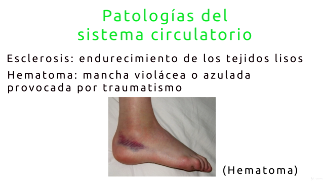 Curso integral de masaje descontracturante – Screenshot 3