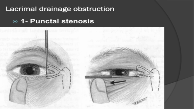 Opthalmology – Screenshot 2