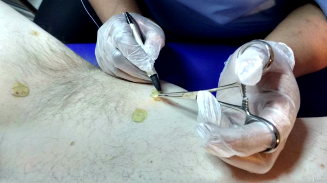 Facials Dermaplaning Certificate – Screenshot 4