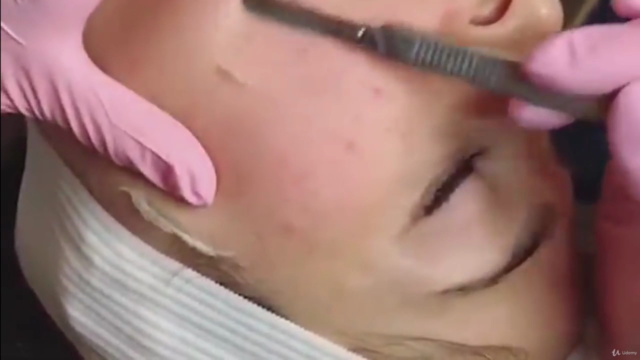 Dermaplaning - The Complete Guide – Screenshot 3