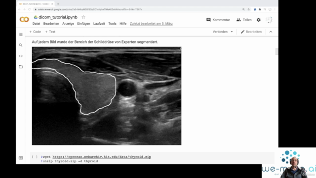 Deep Learning & künstliche Intelligenz in der Medizin fastai – Screenshot 3