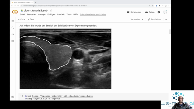 Deep Learning & künstliche Intelligenz in der Medizin fastai – Screenshot 4
