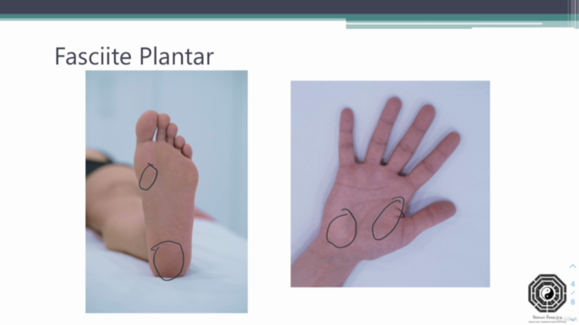 Acupuntura para Alívio Imediato da Dor – Screenshot 3