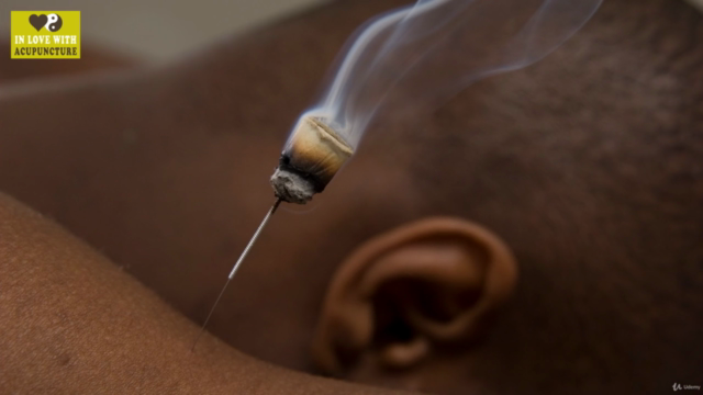 Understanding Acupuncture – Screenshot 3