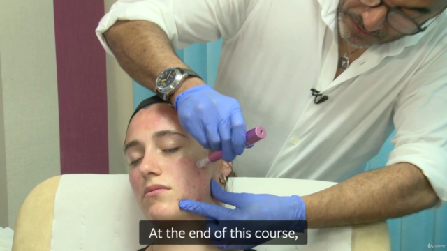 Microneedling – A Guide to Collagen Induction Therapy – Screenshot 3