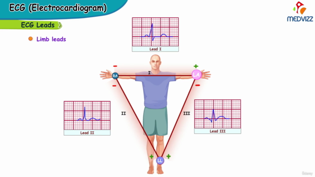 Certificate Course in ECG Interpretation/ Electrocardiogram – Screenshot 4