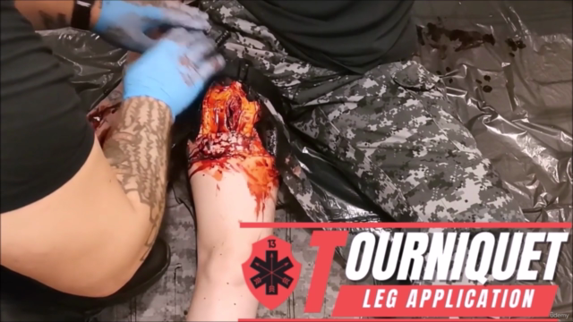 Civilian Trauma Response – Screenshot 1