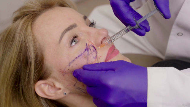 Fillers: Hyaluronic acid injections for jawline and nose - Screenshot_04