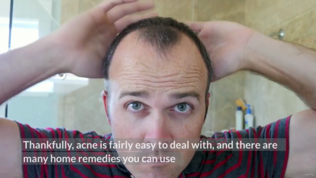How to Get Rid of Acne and Acne Scars Fast With Home Remedie - Screenshot_01